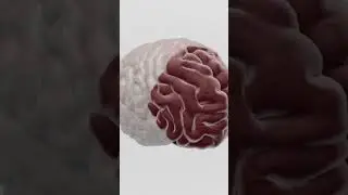 Inside a Schizophrenic Brain 🧠😮#shorts