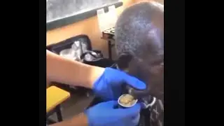 **MAN'S FACE IS MILKED LIKE A COW 🐄🥛**  | INSANE PIMPLE POPPING COMPILATION!