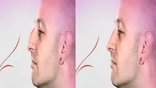 Yamuk Eğik Burun Çene Düzeltme (PHOTOSHOP DERSLERİ)