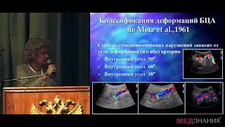 01 Патологическая извитость внутренних сонных артерий как одна из причин сосудистых повреждений нерв