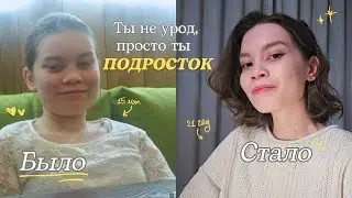 Естественный glow up | Если ты подросток, посмотри это видео