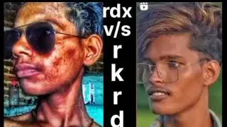 🙏rdx vs SR editor 999  trending #video 📸 Lightroom  edit short video HDR CB 🙏photo 💯#1000subscriber