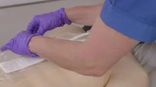 PICO 14 Dressing Removal