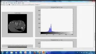 Imadjust Histogram equalisation in Matlab