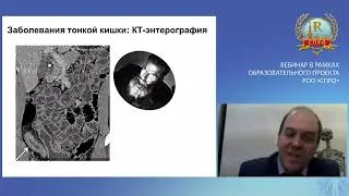 ИЗБРАННЫЕ ВОПРОСЫ ЛУЧЕВОЙ ДИАГНОСТИКИ ЗАБОЛЕВАНИЙ КИШЕЧНИКА