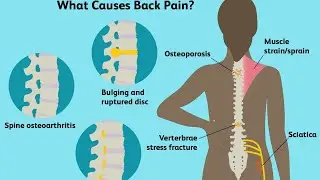 Back Pain STINKS #backpain #foryou