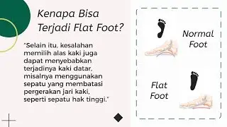 Yuk! Kenali Pes Planus (Flat Foot) RS Husada Utama Surabaya