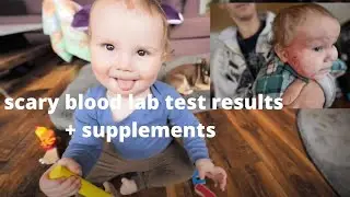 Best treatment for Eczema | Eczema Relief for Bad Eczema Toddler | Aron Regimen | Dr. Sheila Kilbane
