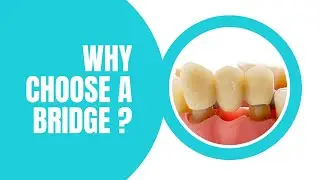 Why choose a bridge? Tooth replacement options explained
