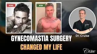 Gynecomastia Commercial 