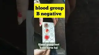 abo blood group |B negative|blood group #shorts #doctorsvlog #dayinthelife #viral #vlog #bloodgroup