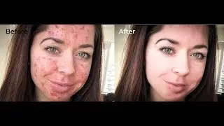 Photo Retouching Tutorial Easiest Way - ছবি রিটাচিং টিউটোরিয়াল