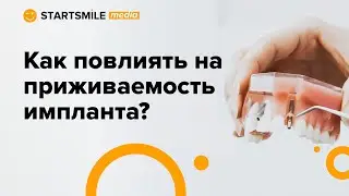 Главные факторы успешной имплантации зубов!
