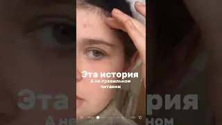 История о моей кожи и что мне помогло #рекомендации #tiktok #rek #жизненныеистории