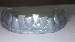 Clear Aligners 3D Printed by: Nirenblatt Orthodontics