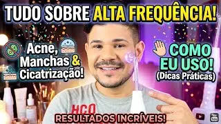 ALTA FREQUÊNCIA PARA A PELE CABELO UNHAS E CRESCIMENTO DE CABELO
