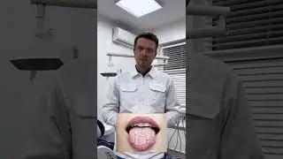 ТОП 3 что опасно в зубной пасте? #стоматолог #зубы #улыбка #топ3 #зубнаяпаста
