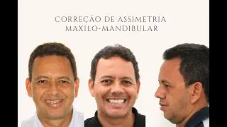 Caso Clínico Mudança de Vida I CIRURGIA ORTOGNÁTICA I Carlos Alberto