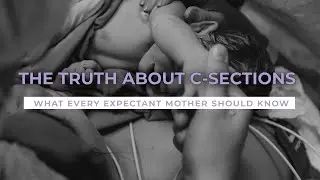 The Truth About C-Sections: What Every Expectant Mother Should Know -  PART 1