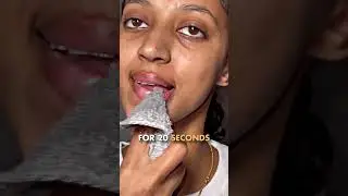 FIX Your LIPS (Looksmaxx Tip #3)