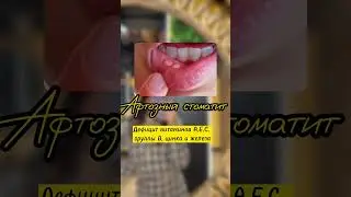 РЕАЛЬНЫЕ ДЕФИЦИТЫ ВИТАМИНОВ🫣