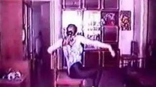 Amputee Lena 1