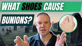 Do shoes cause bunions? (Let's dig up graves to find out.......)