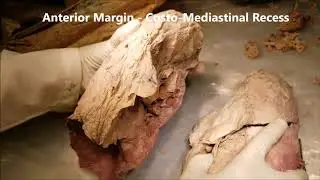 LUNGS 1 Costal Surface Features Lobar Pneumonia and Other Clinical Aspects – Sanjoy Sanyal