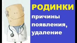 Родинки на теле и лице: причины появления, удаление