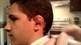 Kırık Kulak Nasıl Düzelir(Kırık Kulak Güreşçi)