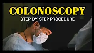 Colonoscopy Procedure Step-by-Step (What to Expect Before, During & After)