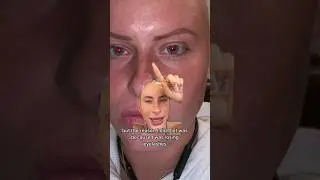 Do I regret getting my eyeliner tattooed - short answer is yes #bald #pmu #eyeliner #alopecia