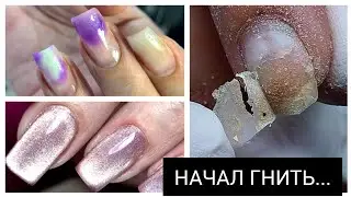 БЕДА с ногтем 