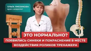 Появились синяки и покраснения на спине от массажа на тренажере-массажере для спины Древмасс
