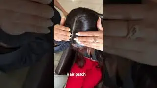 #ads