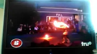 Fire spinning gone wrong