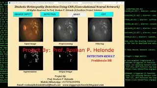 Python Code for Diabetic Retinopathy Detection Using CNN | Python OpenCV Project 