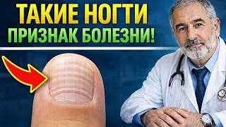 Посмотрите на ногти — это может спасти вам жизнь! Тайные знаки вашего тела