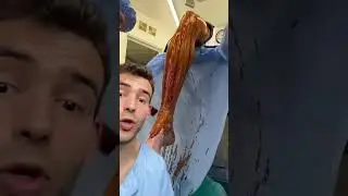 Nunca he trabajado en quirófano 