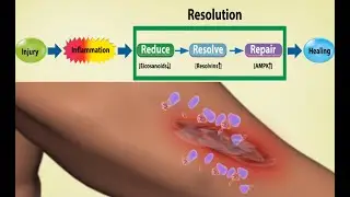 Dietary Technologies to Optimize Healing from Injury-Induced Inflammation