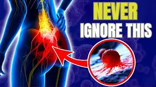 5 Critical Colon Cancer Symptoms That You Should Never Ignore | Hab Healthy