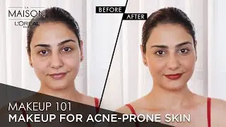 How To Cover Pimples & Acne Scars Ft. Simmy Goraya | Makeup For Acne Prone Skin | L’Oréal Paris