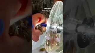 Black head removal on face - Blackheads on back treatment