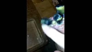 my dead toes falling off
