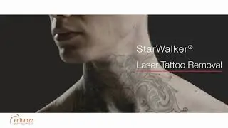 Tattoo Removal by Fotona Starwalker  @ Enhanze Clinic Malaysia