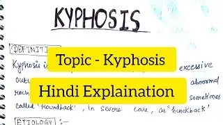 Kyphosis | Definition | Causes | Signs & Symptoms | Diagnosis | Treatment  |