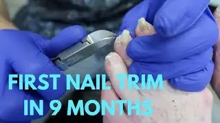 FIRST NAIL TRIM IN 9 MONTHS! **FULL TREATMENT**