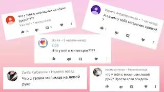 Что с моими мизинцами? Сломана ? Кривой мизинец!