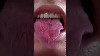 Got me looking at my tongue