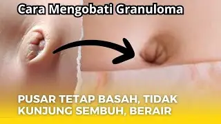 Pengalaman Mengobati Granuloma Pada Bayi (BERDASARKAN PENGALAMAN PRIBADI)